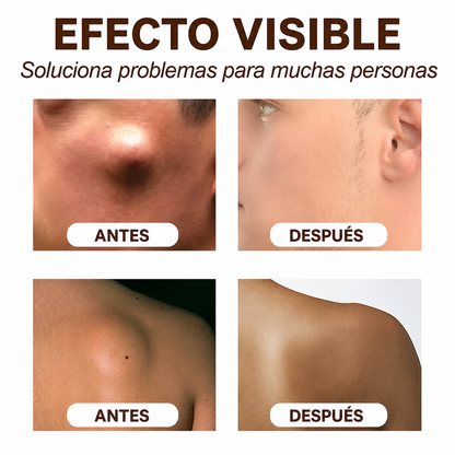 Crema para el cuidado de la piel, alivia la aglomeración del cuerpo y bloques duros.